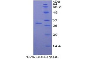 SDS-PAGE (SDS) image for Myosin IG (MYO1G) (AA 769-1016) protein (His tag) (ABIN1877769) (MYO1G Protein (AA 769-1016) (His tag))