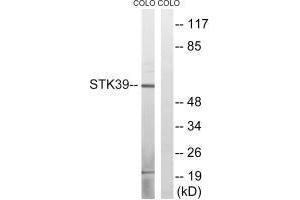 Western blot analysis of extracts from COLO cells, using STK39 (Ab-311) antibody. (STK39 抗体  (Ser311))