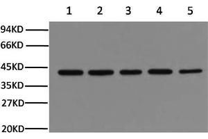 Western Blotting (WB) image for anti-Actin, beta (ACTB) antibody (ABIN5958070) (beta Actin 抗体)