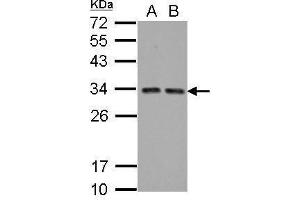 WB Image Sample (30 ug of whole cell lysate) A: A431 B: HeLa 12% SDS PAGE antibody diluted at 1:5000 (HIV-1 Tat Interactive Protein 2, 30kDa (HTATIP2) 抗体)