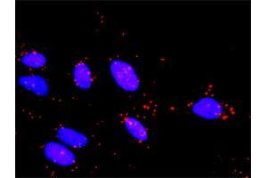 Proximity Ligation Analysis of protein-protein interactions between MAP2K3 and TAOK2. (TAO Kinase 2 抗体  (AA 831-930))