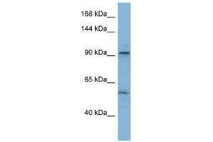 ATP2A1 antibody used at 1 ug/ml to detect target protein. (ATP2A1/SERCA1 抗体  (N-Term))