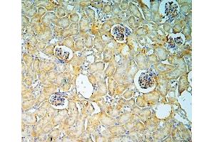 IHC analysis of ANXA3 using anti-ANXA3 antibody (ABIN6719269). (Annexin A3 抗体  (AA 23-323))