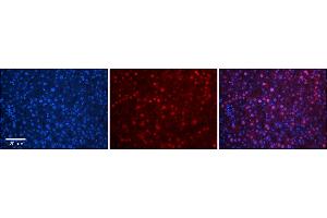 Rabbit Anti-TBX10 Antibody      Formalin Fixed Paraffin Embedded Tissue: Human Adult Liver   Observed Staining: Nuclear in hepatocytes, strong signal, wide tissue distribution  Primary Antibody Concentration: 1:100  Secondary Antibody: Donkey anti-Rabbit-Cy3  Secondary Antibody Concentration: 1:200  Magnification: 20X  Exposure Time: 0. (T-Box 10 抗体  (N-Term))