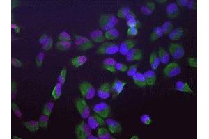 Immunofluorescence of HeLa cells showing strong granular nuclear staining of SAP49 in red and vimentin ( ABIN361371) in green. (SF3B4 抗体)