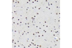Immunohistochemistry of paraffin-embedded mouse brain using PRP19 Rabbit mAb (ABIN7269505) at dilution of 1:100 (40x lens). (PRP19 抗体)