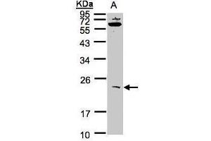 WB Image Sample(30 ug whole cell lysate) A:293T 12% SDS PAGE antibody diluted at 1:1000 (UBE2M 抗体)