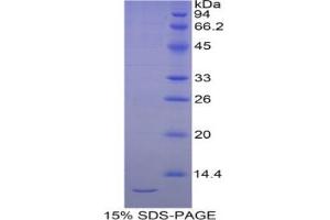 SDS-PAGE analysis of Human Selenoprotein W1 Protein. (Selenoprotein W 蛋白)