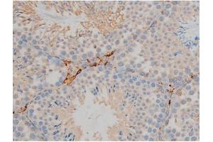 ABIN6267352 at 1/200 staining Mouse testis tissue sections by IHC-P. (Bcl-2 抗体  (pSer70))