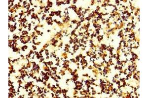 Immunohistochemistry of paraffin-embedded human appendix tissue using ABIN7165176 at dilution of 1:100 (CNPY4 抗体  (AA 22-248))