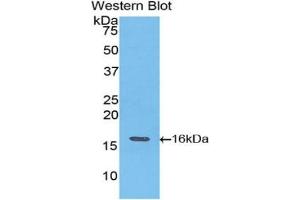 Western blot analysis of the recombinant protein. (TNNT3 抗体  (AA 147-269))