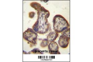 CGB/HCG-Beta Antibody immunohistochemistry analysis in formalin fixed and paraffin embedded human placenta tissue followed by peroxidase conjugation of the secondary antibody and DAB staining. (CGB 抗体  (C-Term))