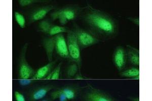 Immunofluorescence analysis of U-2 OS cells using VCP Polyclonal Antibody at dilution of 1:100. (VCP 抗体)