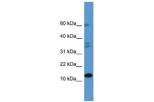 HINT2 antibody (70R-10019) used at 0. (HINT2 抗体  (C-Term))