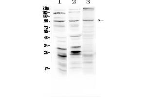 Western Blotting (WB) image for anti-Sema Domain, Immunoglobulin Domain (Ig), Short Basic Domain, Secreted, (Semaphorin) 3A (SEMA3A) (AA 21-223) antibody (ABIN5519059)