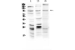 Western blot analysis of Semaphorin 3A using anti-Semaphorin 3A antibody . (SEMA3A 抗体  (AA 21-223))
