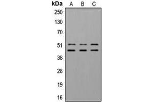 Western blot analysis of GSK3 alpha/beta (pY279/216) expression in A549 insulin-treated (A), NIH3T3 insulin-treated (B) whole cell lysates. (GSK3 alpha/beta 抗体  (pTyr216, pTyr279))