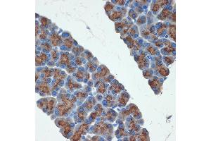 Immunohistochemistry of paraffin-embedded rat pancreas using PRSS2 Rabbit mAb (ABIN7269580) at dilution of 1:100 (40x lens). (PRSS2 抗体)
