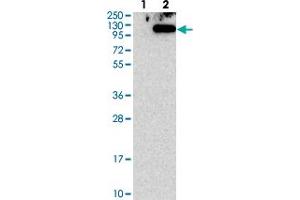 Western blot analysis of Lane 1: Negative control (vector only transfected HEK293T lysate). (TSR1 抗体)