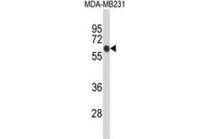 Western Blotting (WB) image for anti-Ankyrin Repeat Domain 13C (ANKRD13C) antibody (ABIN5024534) (ANKRD13C 抗体)