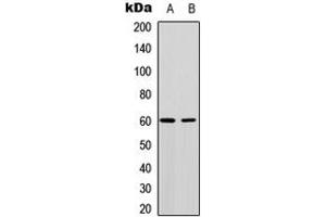 Western blot analysis of AKT expression in MCF7 (A), NIH3T3 (B) whole cell lysates. (AKT1 抗体  (Center))