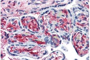 Immunohistochemistry (Formalin-fixed Paraffin-embedded Sections) (IHC (fp)) image for anti-Proprotein Convertase Subtilisin/kexin Type 6 (PCSK6) (Internal Region) antibody (ABIN461695)