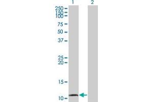 Western Blot analysis of CCL15 expression in transfected 293T cell line by CCL15 monoclonal antibody (M01), clone 1D7. (CCL15 抗体  (AA 25-113))