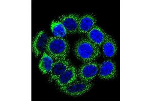 Immunofluorescence (IF) image for anti-Cytochrome P450, Family 21, Subfamily A, Polypeptide 2 (CYP21A2) (AA 216-246) antibody (ABIN652409)