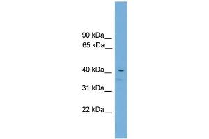 WB Suggested Anti-Acd Antibody Titration:  0. (ACD 抗体  (C-Term))