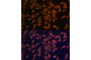 Immunofluorescence analysis of C6 cells using CENPC Rabbit mAb (ABIN7266273) at dilution of 1:100 (40x lens). (Centromere Protein C Pseudogene 1 (CENPCP1) 抗体)