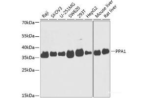 Western blot analysis of extracts of various cell lines using PPA1 Polyclonal Antibody at dilution of 1:1000. (Pyrophosphatase (Inorganic) 1 (PPA1) 抗体)