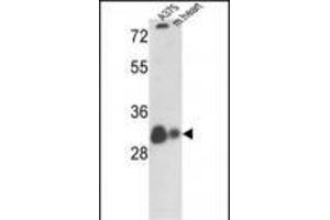 Western Blotting (WB) image for anti-Voltage-Dependent Anion Channel 1 (VDAC1) (AA 1-30), (N-Term) antibody (ABIN390563)