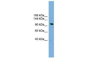 VPS41 antibody used at 0. (VPS41 抗体  (Middle Region))