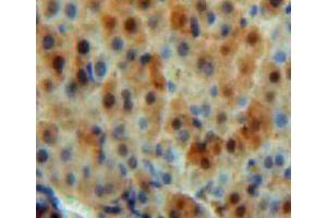 Used in DAB staining on fromalin fixed paraffin-embedded liver tissue (CA5B 抗体  (AA 174-311))