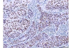 IHC analysis of MSH2 using anti-MSH2 antibody (ABIN7601369). (MSH2 抗体  (AA 337-583))