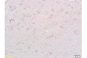 Formalin-fixed and paraffin embedded: rat brain tissue labeled with Anti-MAP1A Polyclonal Antibody , Unconjugated at 1:200, followed by conjugation to the secondary antibody and DAB staining (MAP1A 抗体  (AA 2651-2750))