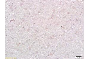 Formalin-fixed and paraffin embedded: rat brain tissue labeled with Anti-MAP1A Polyclonal Antibody , Unconjugated at 1:200, followed by conjugation to the secondary antibody and DAB staining (MAP1A 抗体  (AA 2651-2750))