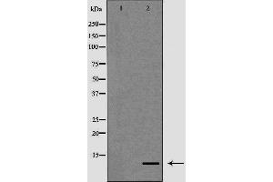 Western blot analysis of K562 cell lysate, using S100A12 Antibody. (S100A12 抗体)