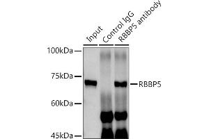 Immunoprecipitation analysis of 300 μg extracts of MCF7 cells using 3 μg RBBP5 antibody (ABIN6128620, ABIN6146741, ABIN6146742 and ABIN6222719). (RBBP5 抗体  (AA 319-538))