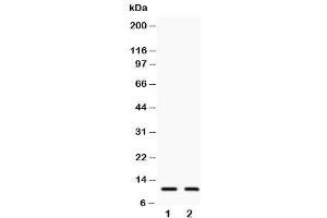 Western blot testing of Eotaxin 3 antibody and Lane 1:  COLO320 (CCL26 抗体  (C-Term))