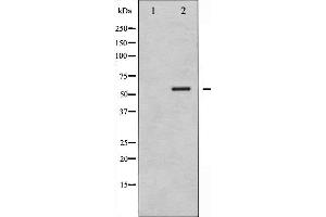 Western blot analysis of G3BP-1 phosphorylation expression in 293 whole cell lysates,The lane on the left is treated with the antigen-specific peptide.