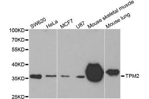 Western Blotting (WB) image for anti-Tropomyosin-2 (TPM2) antibody (ABIN1875181) (TPM2 抗体)