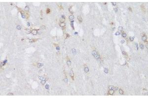 Immunohistochemistry of paraffin-embedded Rat brain using FA2H Polyclonal Antibody at dilution of 1:150 (40x lens). (FA2H 抗体)