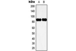 Western blot analysis of Cortactin (pY466) expression in HeLa UV-treated (A), NIH3T3 H2O2-treated (B) whole cell lysates. (Cortactin 抗体  (C-Term, pTyr466))