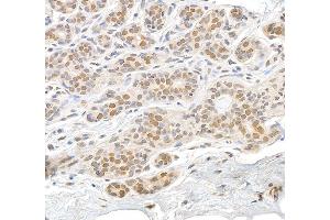 Immunohistochemistry (IHC) image for anti-RAN, Member RAS Oncogene Family (RAN) (AA 166-216) antibody (ABIN7455018) (RAN 抗体  (AA 166-216))