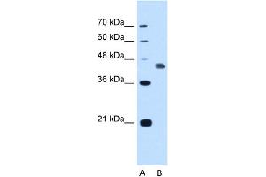 WB Suggested Anti-DFNA5 Antibody Titration:  1. (DFNA5 抗体  (C-Term))