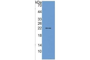 WB of Protein Standard: different control antibodies against Highly purified E. (PTGDS ELISA 试剂盒)