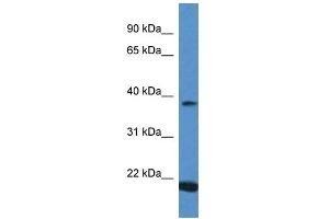 Western Blot showing IFNA13 antibody used at a concentration of 1 ug/ml against Placenta Lysate (IFNA13 抗体  (C-Term))
