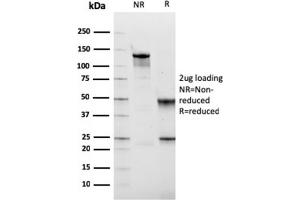 SDS-PAGE Analysis Purified Fibronectin Mouse Monoclonal Antibody (FN1/2949).