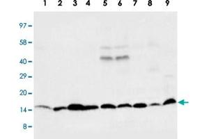 Western blot analysis of tissue and whole cell extracts with Ccl4 polyclonal antibody . (CCL4 抗体  (C-Term))